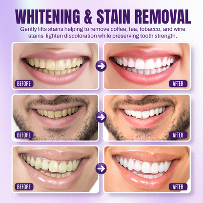 NEGUSY™ Teeth Restoration Mineral Powder