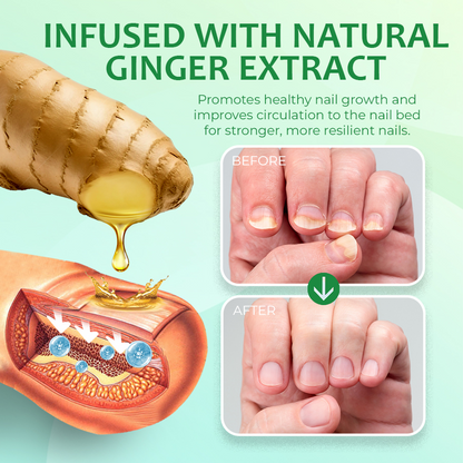 Ginger Nail Treatment Nail Support Nail Care