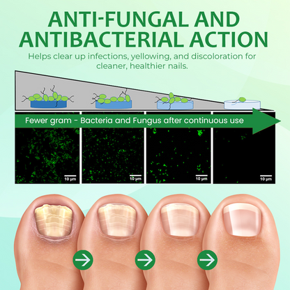 Ginger Nail Treatment Nail Support Nail Care