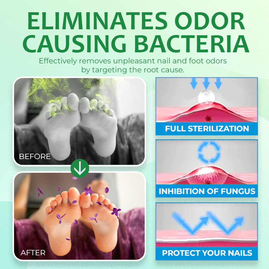 Ginger Nail Treatment Nail Support Nail Care