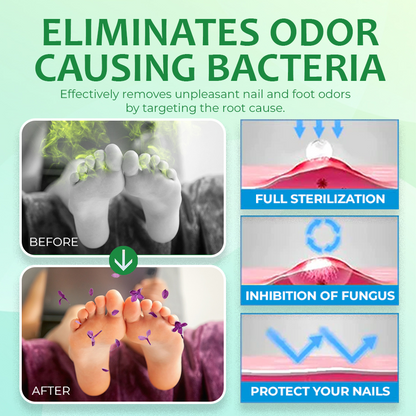 Ginger Nail Treatment Nail Support Nail Care