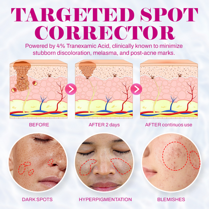 Revive Cream: Abutin 7% + Traneaxamic Acid 4%