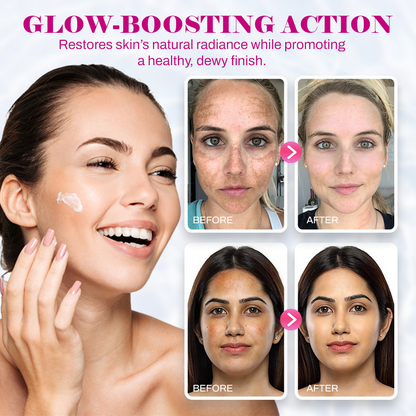 Revive Cream: Abutin 7% + Traneaxamic Acid 4%