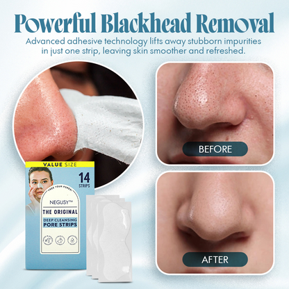 NEGUSY Powerful Pore Purifying Strips