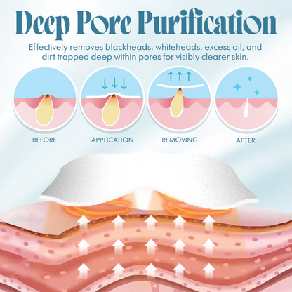 NEGUSY Powerful Pore Purifying Strips