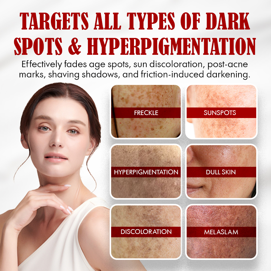 NEGUSY™ Body Whitening Cream - Joints, Underarms, Private Areas