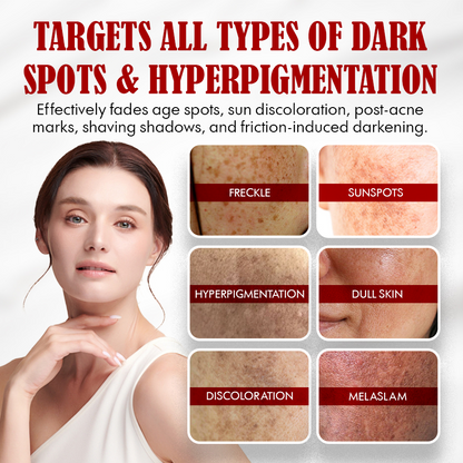 NEGUSY™ Body Whitening Cream - Joints, Underarms, Private Areas