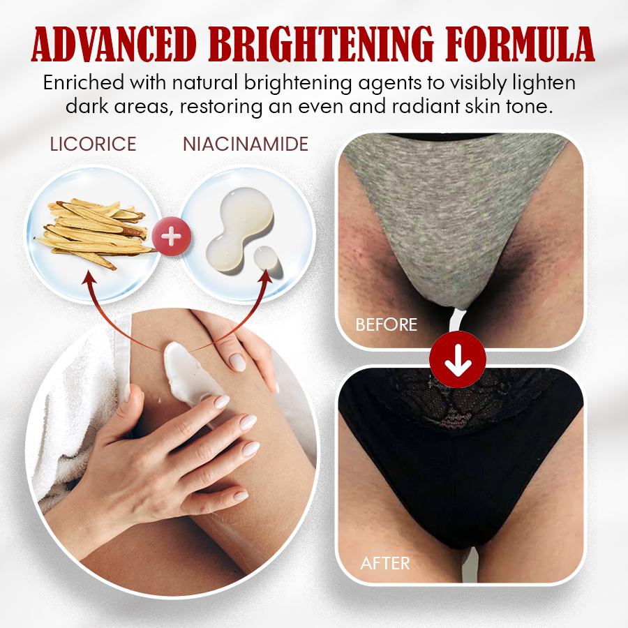 NEGUSY™ Body Whitening Cream - Joints, Underarms, Private Areas