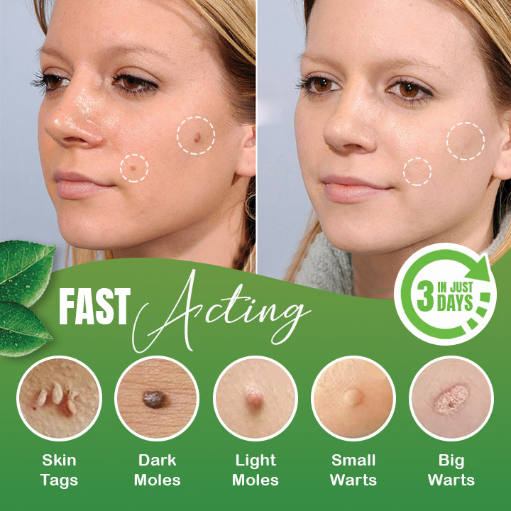 🔹Skin Tag Herbal Removal Patch