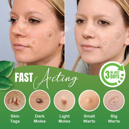 🔹Skin Tag Herbal Removal Patch