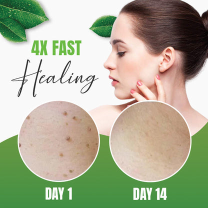 🔹Skin Tag Herbal Removal Patch