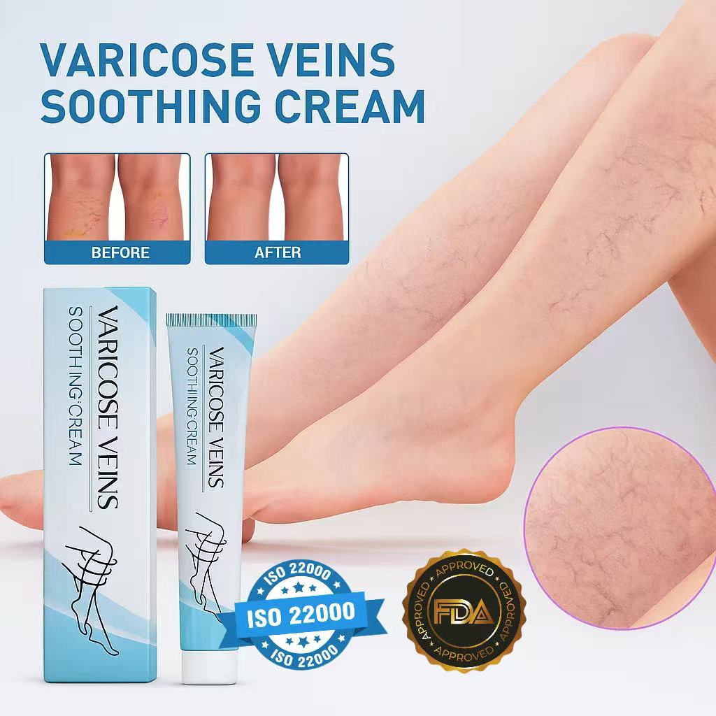 LBMLBM™ Effective Varicose Vein Relief Cream – Soothe Leg Pain & Improve Circulation