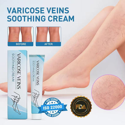 LBMLBM™ Effective Varicose Vein Relief Cream – Soothe Leg Pain & Improve Circulation