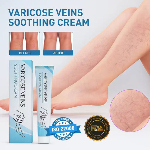 LBMLBM™ Effective Varicose Vein Relief Cream – Soothe Leg Pain & Improve Circulation