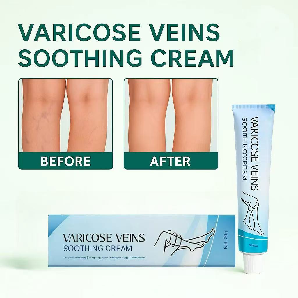 LBMLBM™ Effective Varicose Vein Relief Cream – Soothe Leg Pain & Improve Circulation
