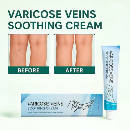 LBMLBM™ Effective Varicose Vein Relief Cream – Soothe Leg Pain & Improve Circulation