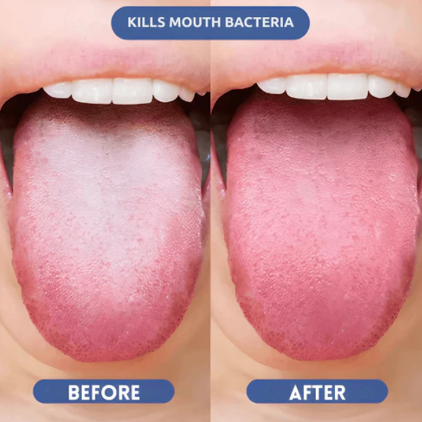 NEGUSY™ Probiotic Oral Mist